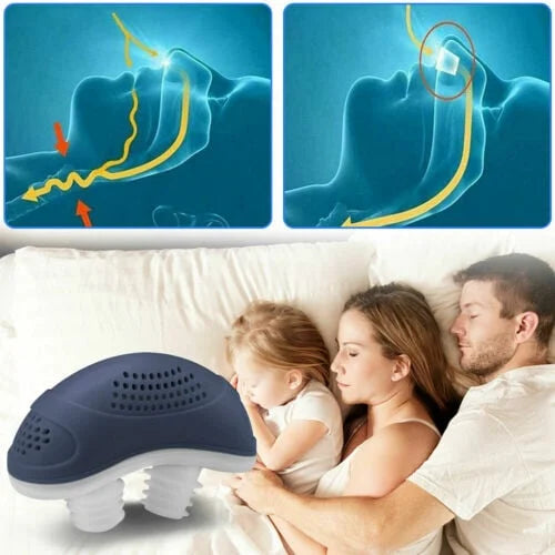 Vivolux | Schlaflos, maskenlos, Micro-CPAP Anti-Schnarch