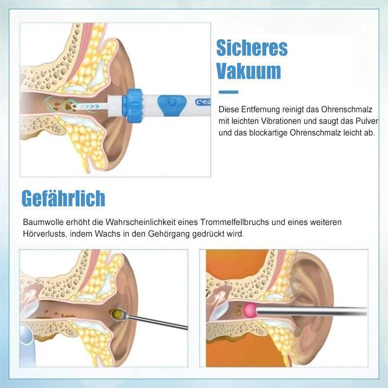 Vivolux | Ohrenschmalzentferner Staubsauger
