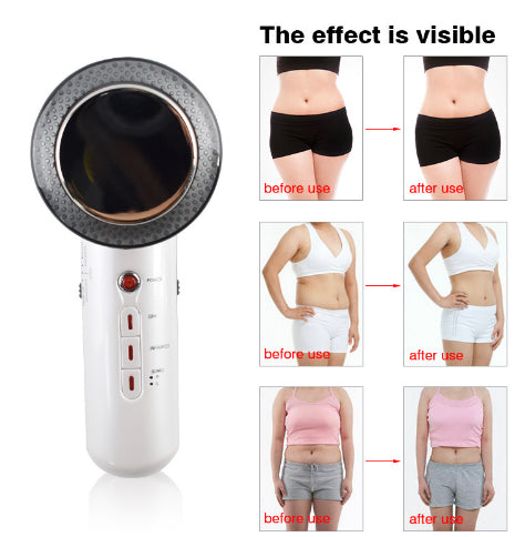 Vivolux | Ultraschall Massagegerät