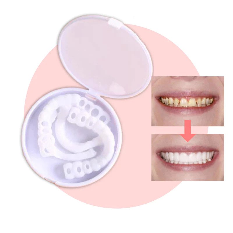 Vivolux | SmileSnap - Immer das perfekte Lächeln mit diesen Veneers