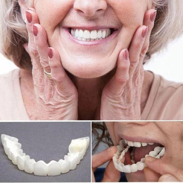 Vivolux | On Smile Veneers (Ober- und Unterkiefer inbegriffen)