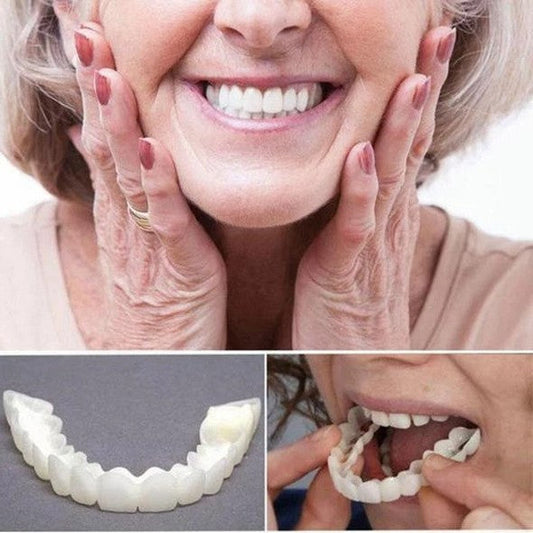 Vivolux | On Smile Veneers (Ober- und Unterkiefer inbegriffen)