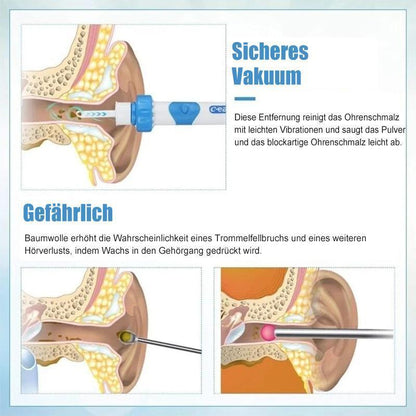 Vivolux | Ohrenschmalzentferner Staubsauger