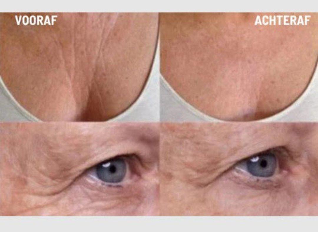 Vivolux | Anti-Falten Silikon-Pads