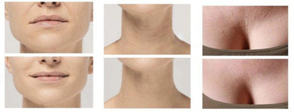 Vivolux | Anti-Falten Silikon-Pads