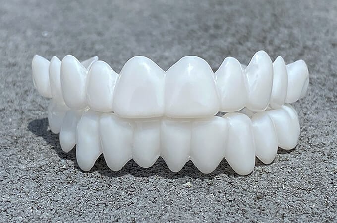 Vivolux | DentAlign Dental Veneers – Natürliche Passform und Komfort