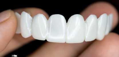 Vivolux | DentAlign Dental Veneers – Natürliche Passform und Komfort