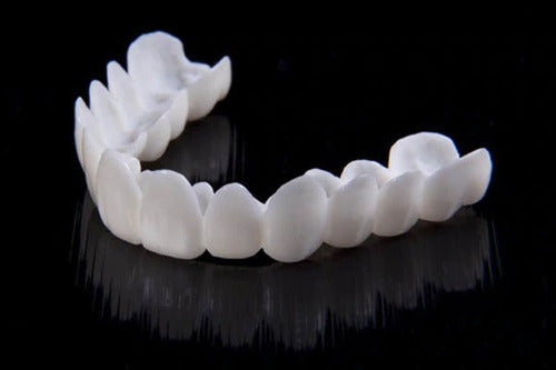 Vivolux | DentAlign Dental Veneers – Natürliche Passform und Komfort