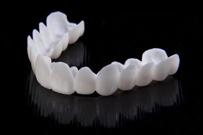 Vivolux | DentAlign Dental Veneers – Natürliche Passform und Komfort