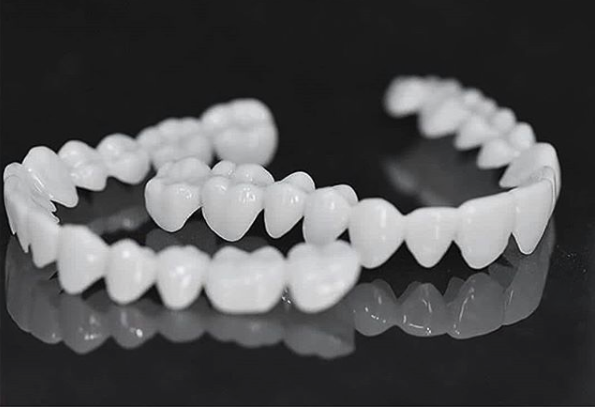 Vivolux | DentAlign Dental Veneers – Natürliche Passform und Komfort