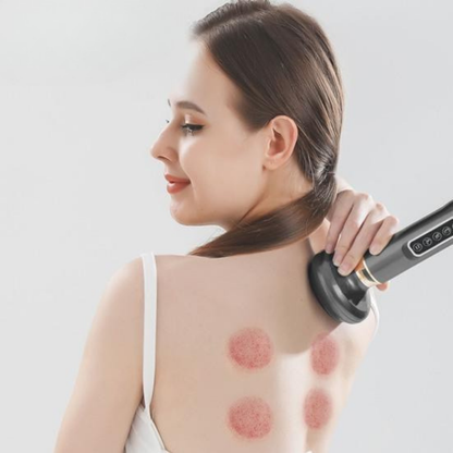 Vivolux | Elektrisches Schröpfmassagegerät zur Muskelregeneration