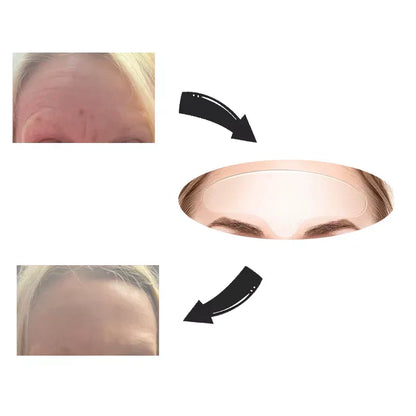 Vivolux | Face Lift Wiederverwendbares Tape