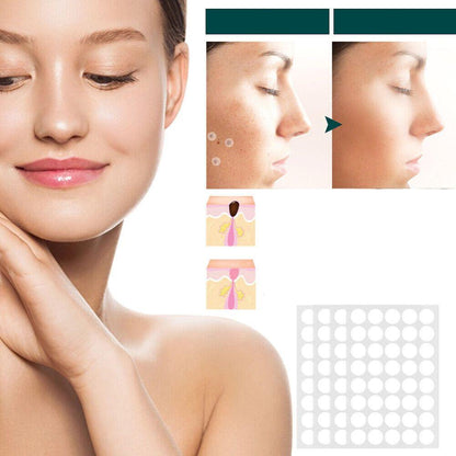 Vivolux | SkinClear - Pflaster zur Entfernung von Flecken und Warzen