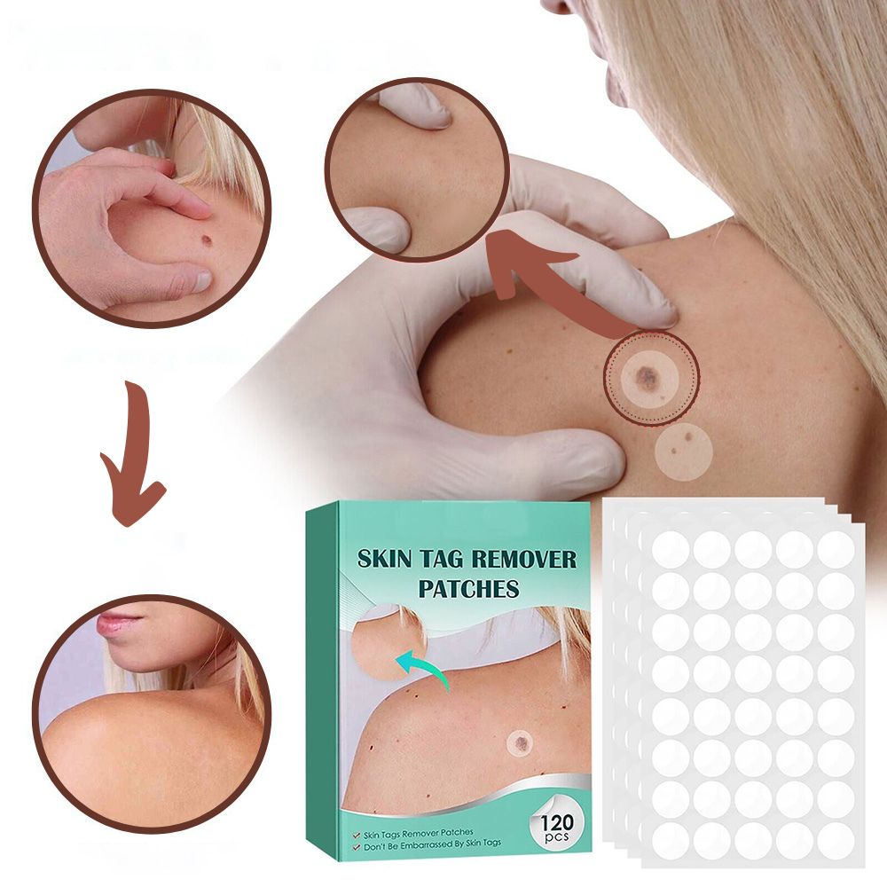 Vivolux | SkinClear - Pflaster zur Entfernung von Flecken und Warzen