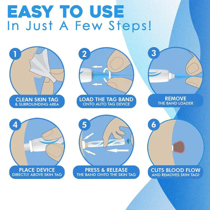 Schnell-Entfernungs-Kit