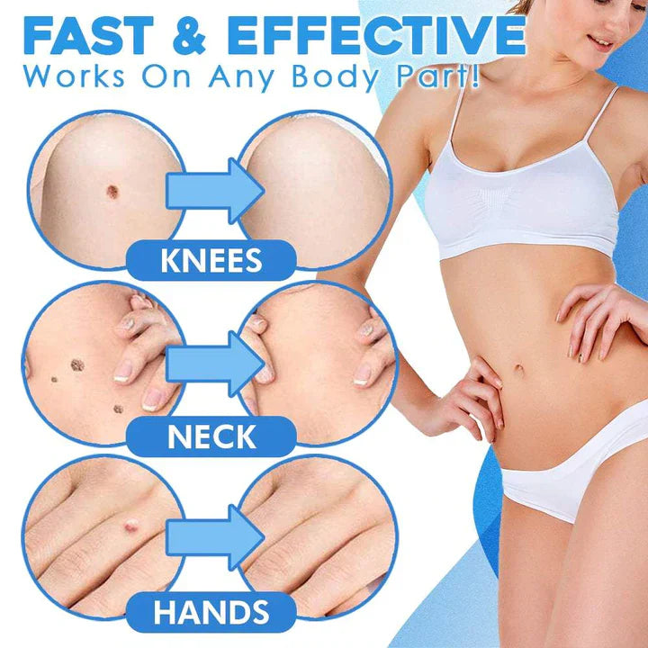 Schnell-Entfernungs-Kit