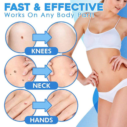 Schnell-Entfernungs-Kit