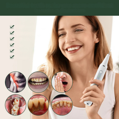 Vivolux | Dental Scaler | Ultraschall-Zahnsteinentferner-Werkzeug für zu Hause