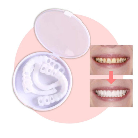 Vivolux | SmileSnap - Immer das perfekte Lächeln mit diesen Veneers
