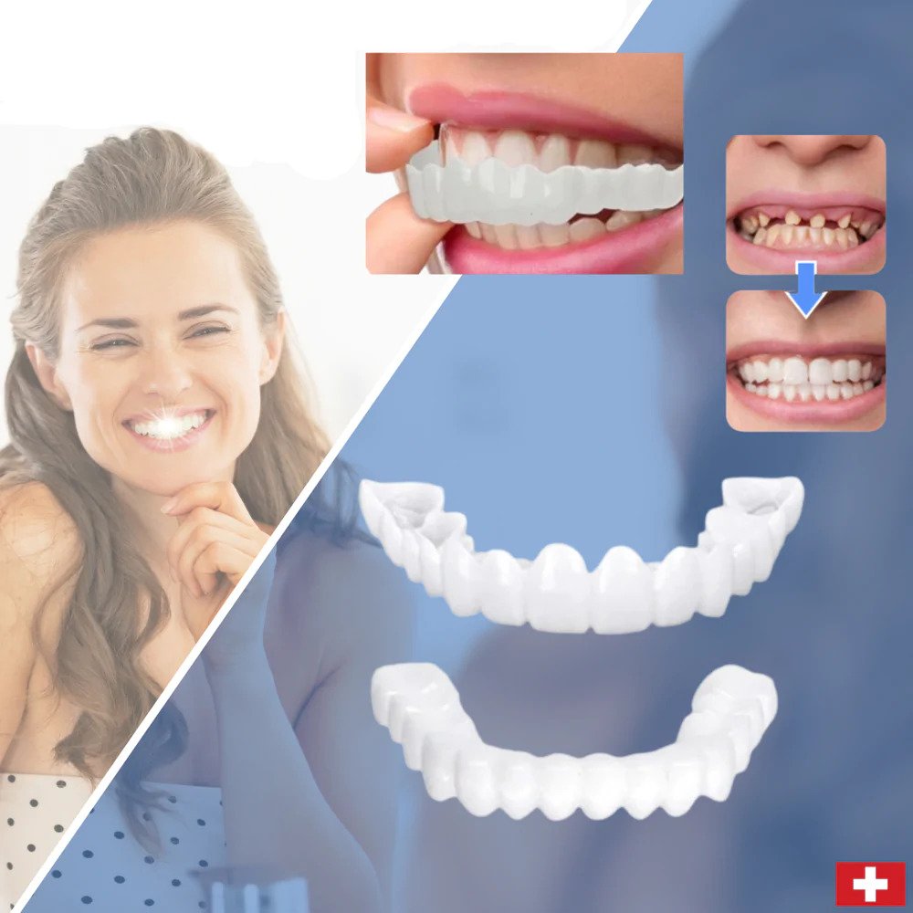 Vivolux | SmileSnap - Immer das perfekte Lächeln mit diesen Veneers