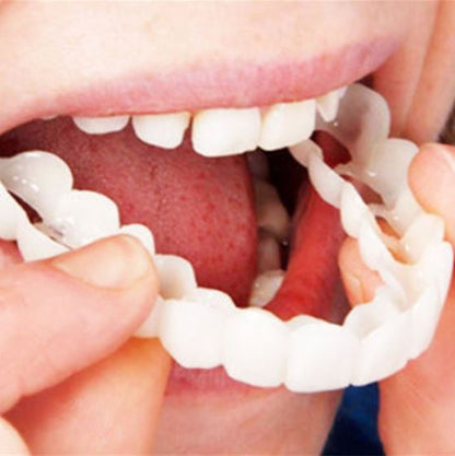Vivolux | SmileSnap - Immer das perfekte Lächeln mit diesen Veneers